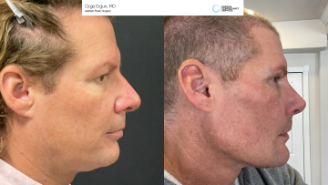 be_af_jawim-_chinim_rhino_necklipo_1_62524926