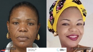 amaka_ba
