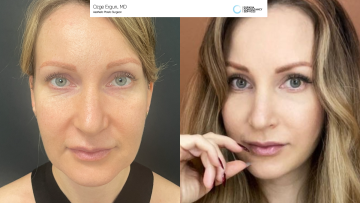 be_af_macsfacelift_1_68942956