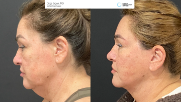be_af_macsfacelift_2_72438220