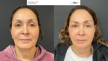 be_af_hw_macsfacelift_1