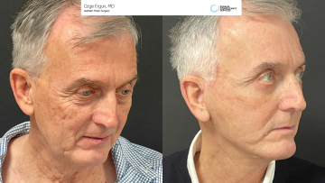 be_af_macsfacelift_1_67647480