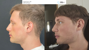be_af_necklipo_69128514