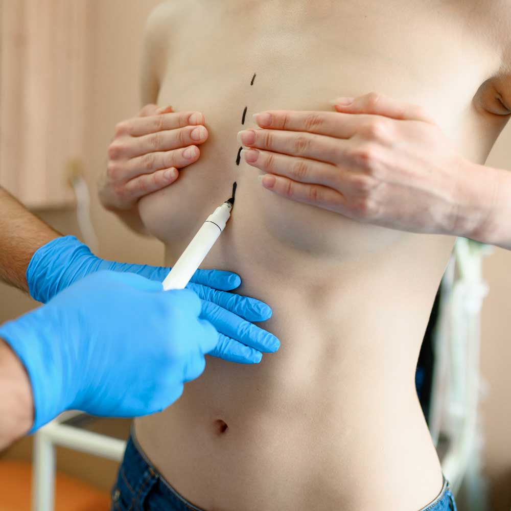 Plastic Surgery